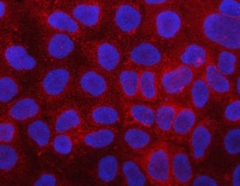 PLC-delta-3 Antibody / PLCD3