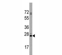 Western blot analysis of CD9 antibody and Jurkat lysate. Predicted molecular weight is 23-27 kDa