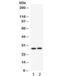 Western blot testing of 1) rat kidney and 2) mouse kidney lysate with IGFBP1 antibody. Expected mole