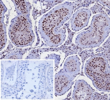 KIF2C Antibody / MCAK