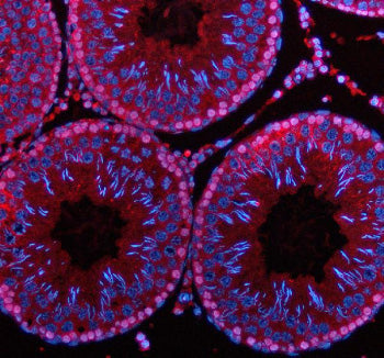 Immunofluorescent staining of PDZD8 using anti-PDZD8 antibody (red). PDZD8 was detected in a paraffi