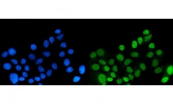 Immunofluorescent staining of FFPE human MCF7 cells with Dynein light chain 1 antibody (green) and D