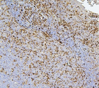 IHC staining of FFPE human tonsil with CD43 antibody. HIER: boil tissue sections in pH6, 10mM citrat