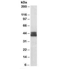 Western blot testing of Jurkat lysate with HLA-B antibody at 0.1ug/ml. Predicted molecular weight: ~