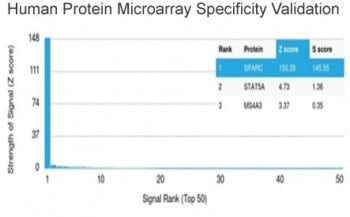 Analysis of HuProt(TM) microarray containing more than 19,000 full-length human proteins using SPARC