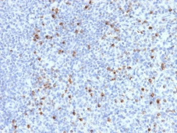 IHC testing of FFPE human spleen with Perforin antibody (clone PRF1/2470). HIER: boil tissue section