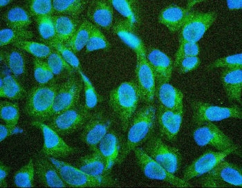 Immunofluorescent staining of FFPE human U-2 OS with TIE2 antibody (green) and DAPI (blue). HIER: bo