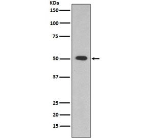 Western blot testing of human HepG2 cell lysate with ALDH1A1 antibody. Predicted molecular weight ~5