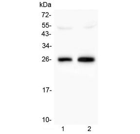 Western blot testing of 1) rat brain and 2) mouse brain lysate with MOG antibody at 0.5ug/ml. Expect