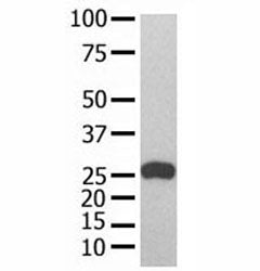 GST Tag Antibody