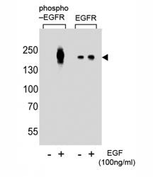 Phospho-EGFR Antibody (pY1016)