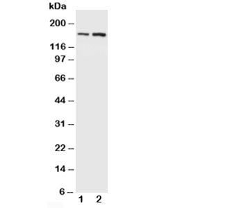 NMDAR2B Antibody