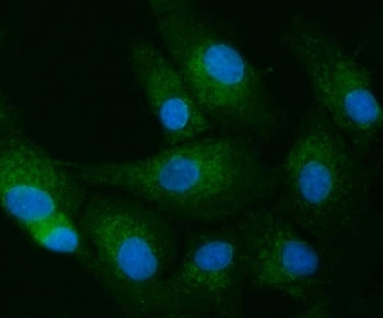 Toll-interacting protein Antibody / TOLLIP