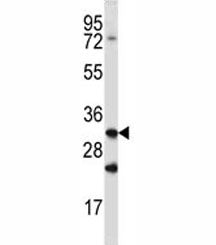 Cathepsin Q antibody western blot analysis in mouse spleen tissue lysate