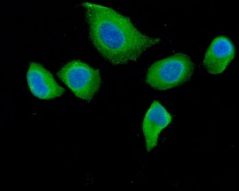 Immunofluorescent staining of FFPE human HeLa cells with DAB2 antibody (green) and DAPI nuclear stai