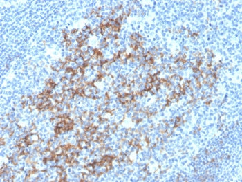 IHC staining of FFPE human tonsil with CD23 antibody (clone FCER2/3592). HIER: boil tissue sections 