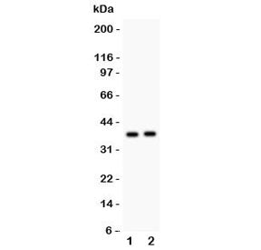Calretinin Antibody