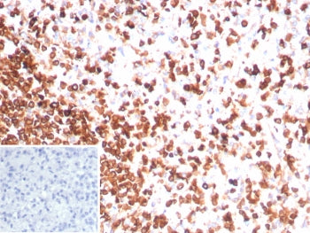IHC staining of FFPE human spleen tissue with recombinant CD3e antibody (clone rC3e/8881). Inset: PB