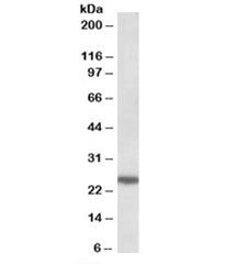 Western blot testing of HeLa lysate with ARHGDIG antibody at 0.5ug/ml. Predicted molecular weight: ~