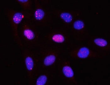 Immunofluorescent staining of FFPE human U-2 OS cells with PPP2R3A antibody (red) and DAPI nuclear s