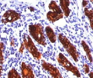TG Antibody / Thyroglobulin
