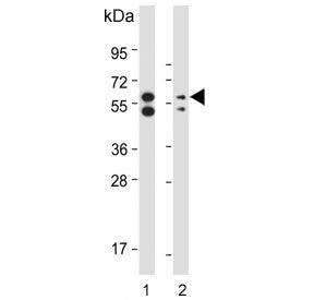 Western blot testing of human 1) HeLa and 2) MCF7 cell lysate with PINK1 antibody. Predicted molecul