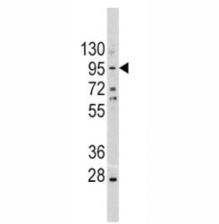 Western blot analysis of anti-E Cadherin antibody and A375 lysate. Expected molecular weight: 135 kD