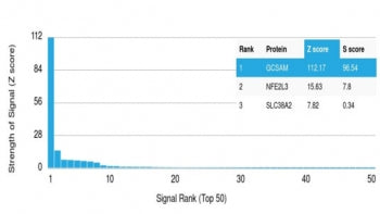 Analysis of a HuProt(TM) microarray containing more than 19,000 full-length human proteins using GCS