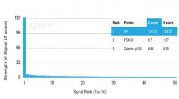 Haptoglobin Antibody