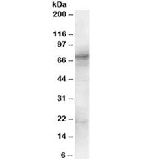 Western blot testing of human spleen lysate with SYK antibody at 1ug/ml. Predicted molecular weight: