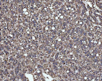 SLU7 Antibody / Pre-mRNA-splicing factor SLU7