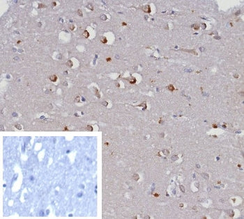 IHC staining of FFPE human brain tissue with KCNJ6 antibody (clone KCNJ6/7557) at 2ug/ml. Inset: PBS
