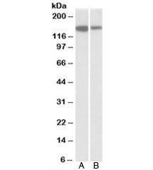 Western blot testing of Jurkat [A] and human thymus [B] lysates with MCF2L antibody at 1ug/ml. Predi