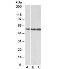 Western blot testing of A) HeLa, B) HepG2 and C) K562 cell lysate using HMGCS1 antibody at 1ug/ml. P