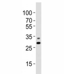Prohibitin Antibody (PHB1)