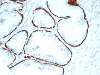 Cytokeratin 14 Antibody / CK14 / KRT14