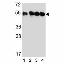 Western blot analysis of TUBB2C antibody and (1) HeLa, (2) MDA-MB435, (3) MDA-MB231, and (4) HepG2 l