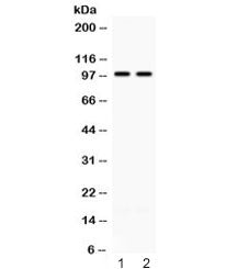ABR Antibody / Active BCR related