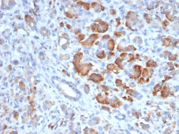 IHC staining of FFPE human pancreas tissue with TRPC6 antibody (clone TRPC6/7672). HIER: boil tissue