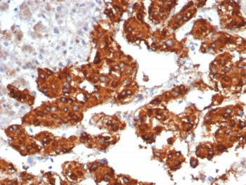 IHC staining of FFPE human adrenal gland tissue with Interleukin-31 antibody (clone IL31/7333). HIER