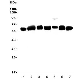 Western blot testing of human 1) U-87 MG, 2) U-937, 3) HepG2, 4) ThP-1, 5) T-47D and 6) PC-3 cell ly