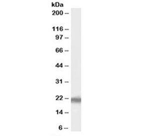 Western blot testing of human liver lysate with PERP antibody at 1ug/ml. Predicted molecular weight: