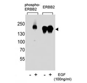Phospho-ErbB2 Antibody (pY1221)