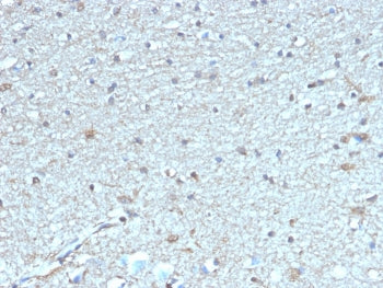 IHC staining of FFPE human brain tissue with LEPR antibody (clone LEPR/4304). HIER: boil tissue sections in pH 9 10mM Tris with 1mM EDTA for 20 min and allow to cool before testing.