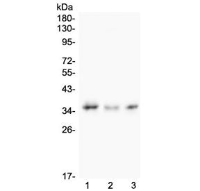Western blot testing of 1) human COLO-320, 2) rat testis and 3) mouse Neuro-2A lysate with Galectin 