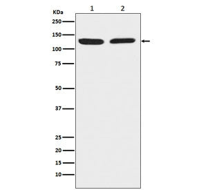 Western blot testing of 1) human HeLa and 2) mouse RAW 264 cell lysate with Chromogranin B antibody.