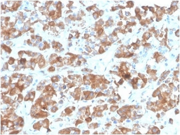 IHC staining of FFPE human pituitary tissue with LH beta antibody (clone rLHb/1613). HIER: boil tissue sections in pH 9 10mM Tris with 1mM EDTA for 20 min and allow to cool before testing.