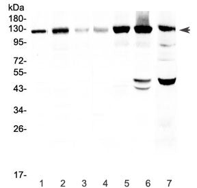 Western blot testing of human 1) HeLa, 2) U-87 MG, 3) SHG-44, 4) COLO320, 5) SKOV3, 6) A549 and 7) m