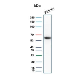 Western blot testing of human kidney tissue lysate with OCLN antibody. Predicted molecular weight ~5