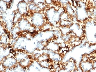 WT1 Antibody / Wilms Tumor 1